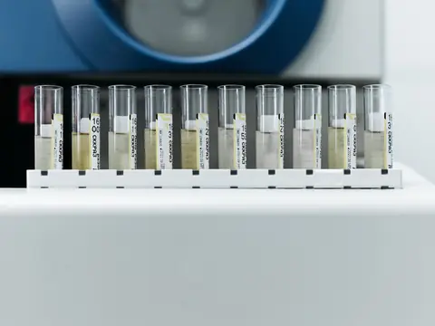 A row of labeled sample tubes in a laboratory rack