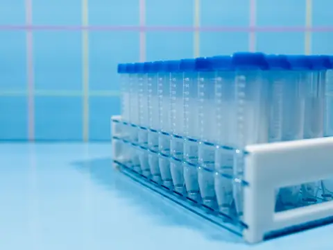 Sample tubes in a rack on a blue laboratory bench